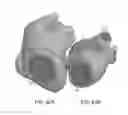 Fig. 59 - Methods and systems for optimizing lesion placement to minimize and treat cardiac fibrillation