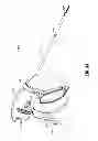 Fig. 04 - Limited-use medical device