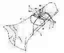 Fig. 01 - Fracture fixation device