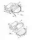 Fig. 02 - Fracture fixation device