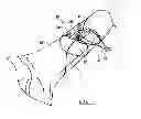 Fig. 06 - Fracture fixation device