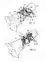 Fig. 07 - Fracture fixation device