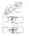 Fig. 09 - Fracture fixation device