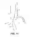 Fig. 06 - ENDOSCOPIC INSTRUMENT