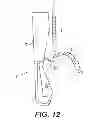 Fig. 07 - ENDOSCOPIC INSTRUMENT