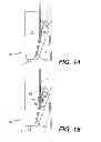 Fig. 09 - ENDOSCOPIC INSTRUMENT