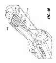Fig. 33 - ENDOSCOPIC INSTRUMENT