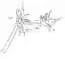 Fig. 01 - EAR BRUSH CLEANER