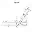 Fig. 06 - VASCULAR CLOSURE SYSTEM TOGGLE PLACEMENT