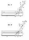 Fig. 07 - VASCULAR CLOSURE SYSTEM TOGGLE PLACEMENT