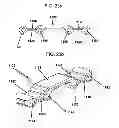 Fig. 49 - Dynamic spinal plating system