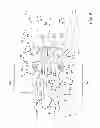 Fig. 06 - Spinal stabilization system and method
