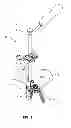 Fig. 02 - Systems and methods for fusing a sacroiliac joint and anchoring an orthopedic appliance