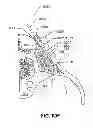 Fig. 97 - Systems and methods for fusing a sacroiliac joint and anchoring an orthopedic appliance