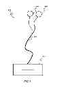 Fig. 02 - SYSTEM AND METHOD OF TREATING INTRACTABLE EPILEPSY BY STIMULATION
