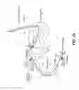 Fig. 35 - NEUROSTIMULATION SYSTEM