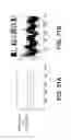 Fig. 41 - NEUROSTIMULATION SYSTEM
