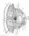 Fig. 44 - NEUROSTIMULATION SYSTEM