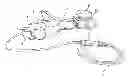 Fig. 01 - Field of view matching in a visual prosthesis