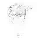Fig. 02 - Field of view matching in a visual prosthesis