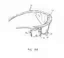 Fig. 06 - Field of view matching in a visual prosthesis