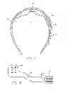 Fig. 08 - Field of view matching in a visual prosthesis