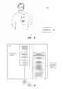 Fig. 07 - Intermittent neural stimulation with physiologic response monitor