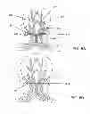 Fig. 08 - Lead having radially spaced apart contacts to allow for adjustability