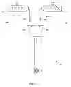 Fig. 09 - Lead having radially spaced apart contacts to allow for adjustability