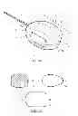 Fig. 02 - Compressible device
