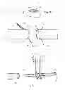 Fig. 07 - Emergency vascular repair prosthesis deployment system