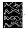 Fig. 03 - Microstructured absorbable implant