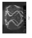 Fig. 05 - Microstructured absorbable implant