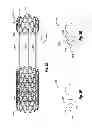 Fig. 08 - INTRAVASCULAR CARDIAC RESTRAINING IMPLANTS AND METHODS FOR TREATING HEART FAILURE
