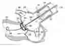 Fig. 01 - Method and apparatus for percutaneous aortic valve replacement