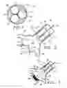 Fig. 02 - Method and apparatus for percutaneous aortic valve replacement