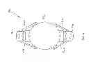 Fig. 06 - Adjustable toric intraocular lens