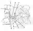 Fig. 01 - Intervertebral cage with anterior fixation and stabilization