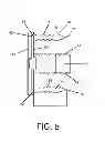 Fig. 09 - Intervertebral cage with anterior fixation and stabilization
