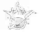 Fig. 01 - Annulus plug for intervertebral disc repair