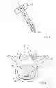 Fig. 02 - Annulus plug for intervertebral disc repair
