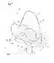 Fig. 02 - Artificial knee joint