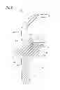 Fig. 06 - Artificial knee joint