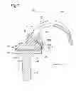 Fig. 08 - Artificial knee joint
