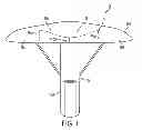 Fig. 02 - System for a knee prosthetic