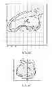 Fig. 23 - Control systems and methods for gait devices