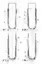Fig. 03 - Suspension liner system with seal