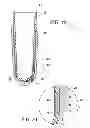 Fig. 07 - Suspension liner system with seal