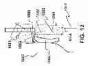 Fig. 16 - Positioning device for automated hair cutting system