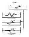 Fig. 04 - Pipe Damage Interpretation System